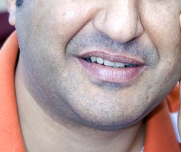 アンケート, イケメン, ヒゲ, モテ, 合コン, 恋愛