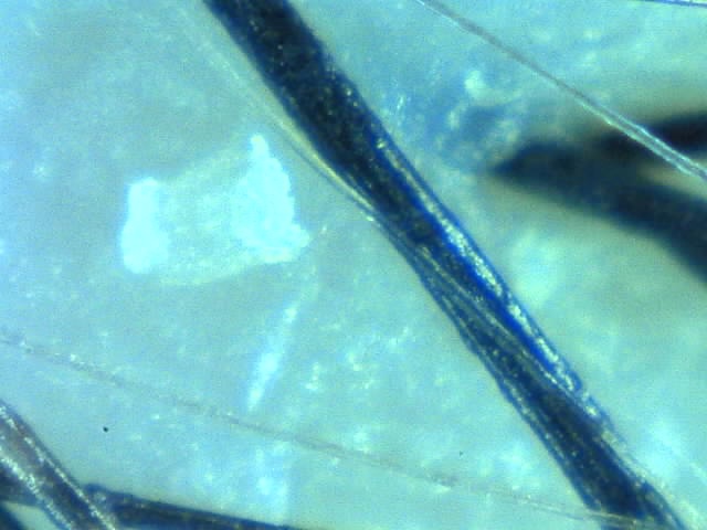 ベルシュヴー,抜け毛,頭皮