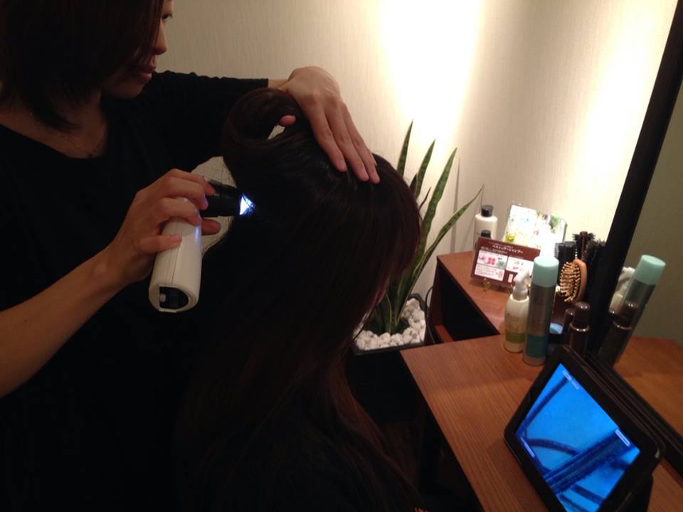 ベルシュヴー,抜け毛,頭皮