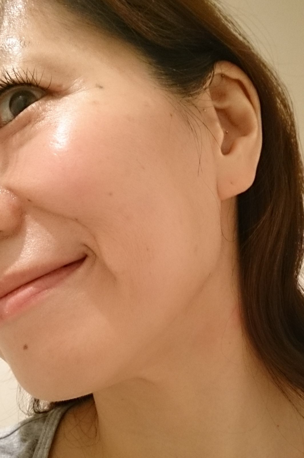 アルティミューンを試して約1週間後の、すっぴん写真