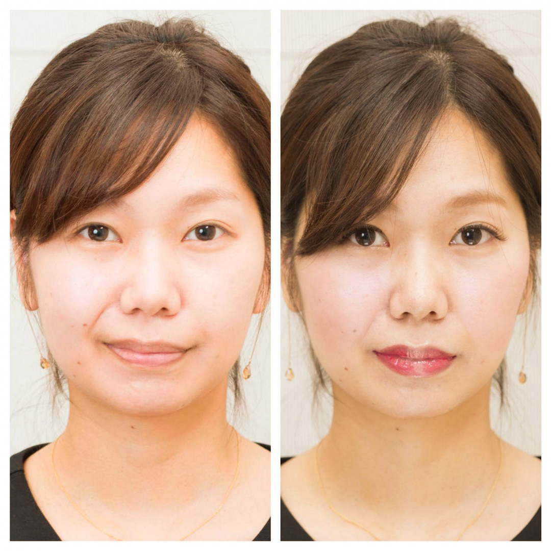 ビフォーアフター