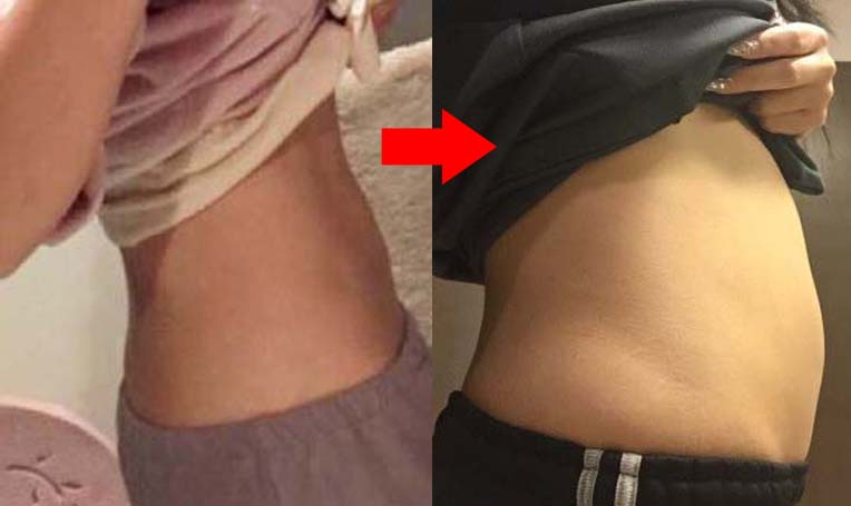 なちゅリバウンド