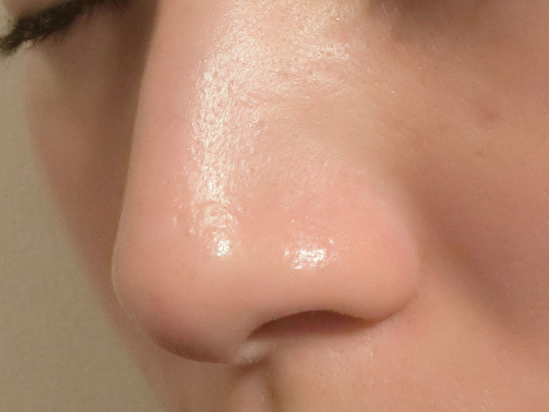 23 years oldのAIR-LAYNIC PORE MASK　使用後