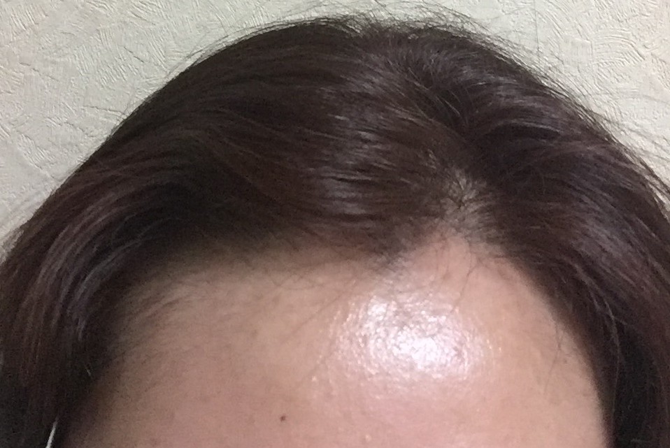 前髪のアフターです。