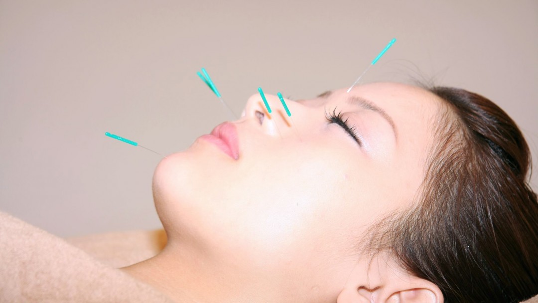 美容鍼のイメージ