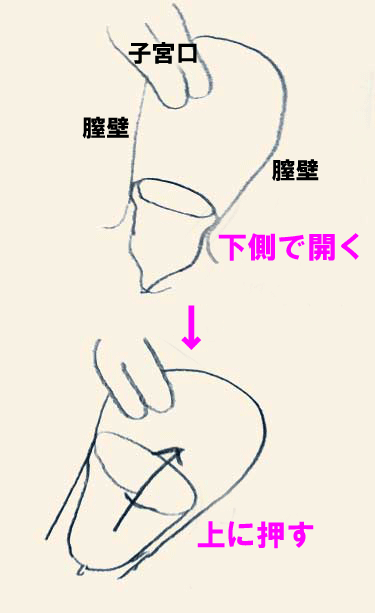 月経カップのスムーズな付け方