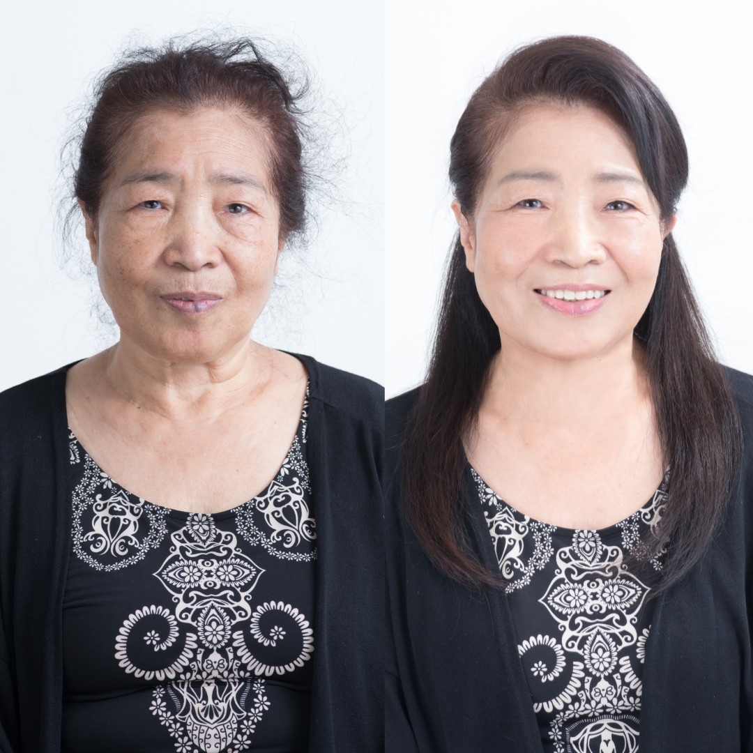 ビフォーアフター2