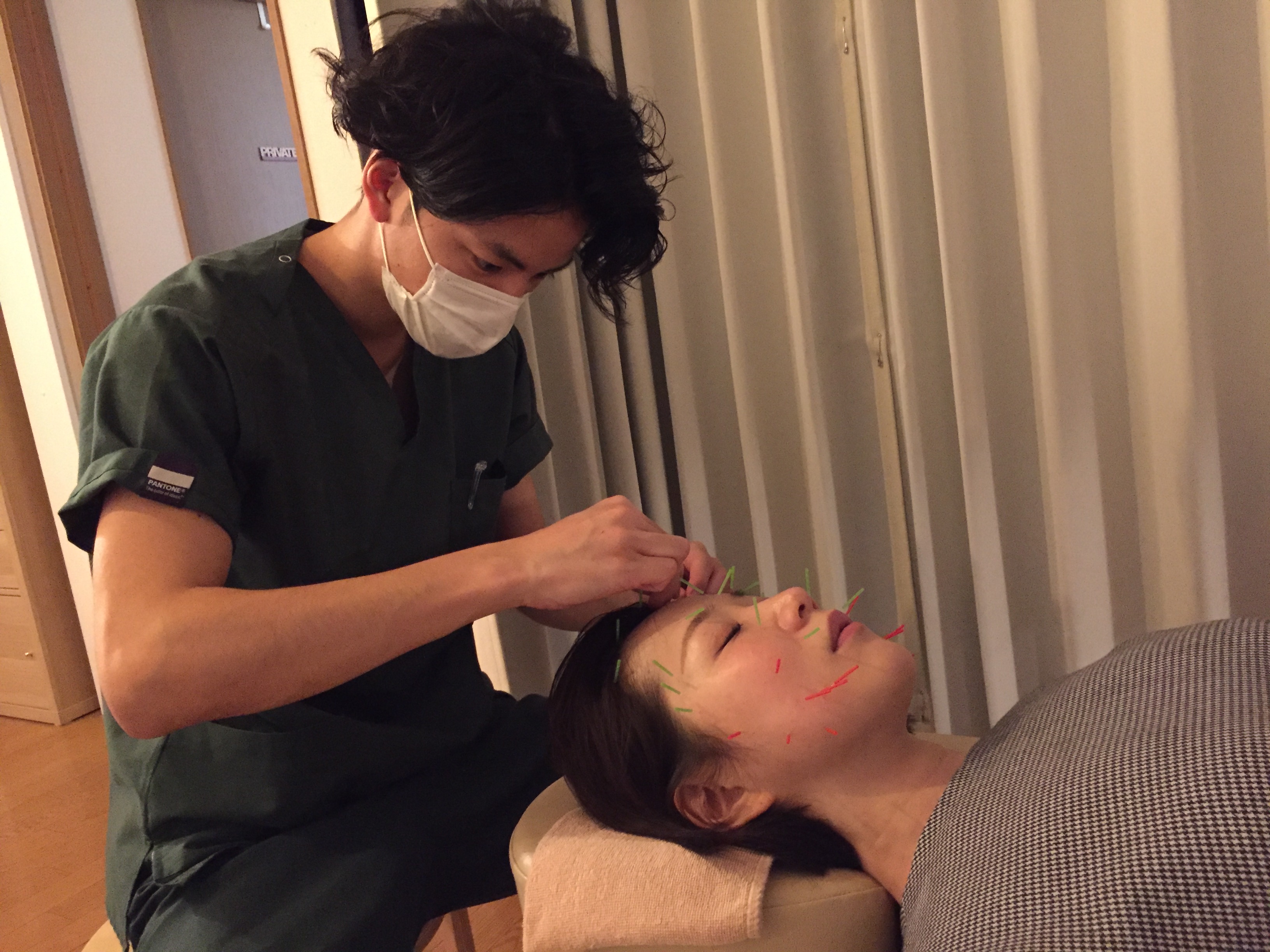 美容鍼（針刺し）