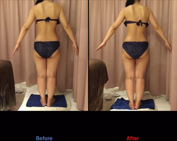 買ってよかった/第2位:エステの体験(1回1万円)