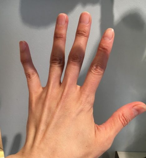 手先から肘まで効果を実感