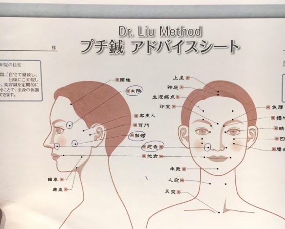 最新美容鍼レポート