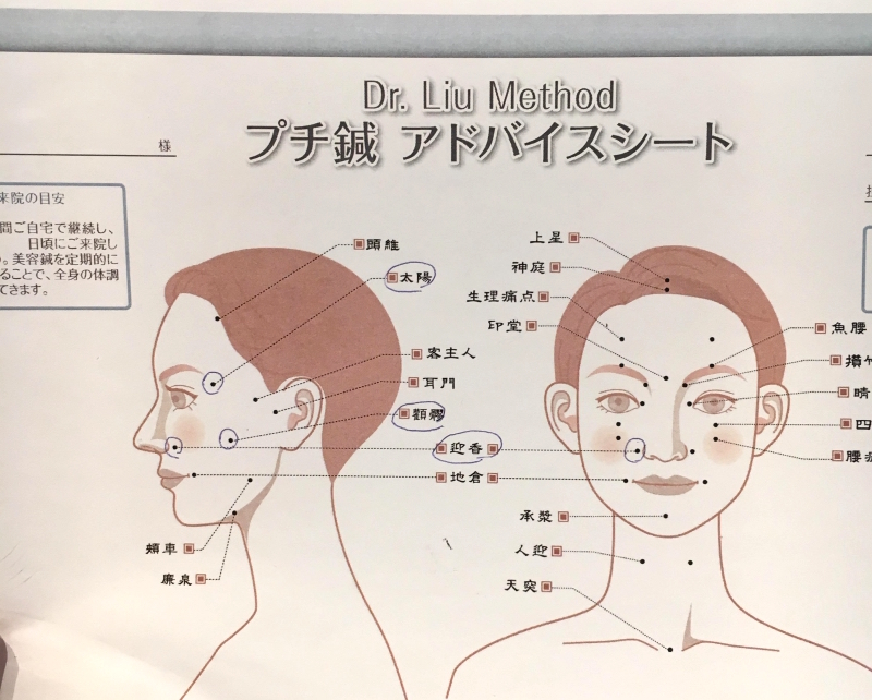 最新美容鍼レポート