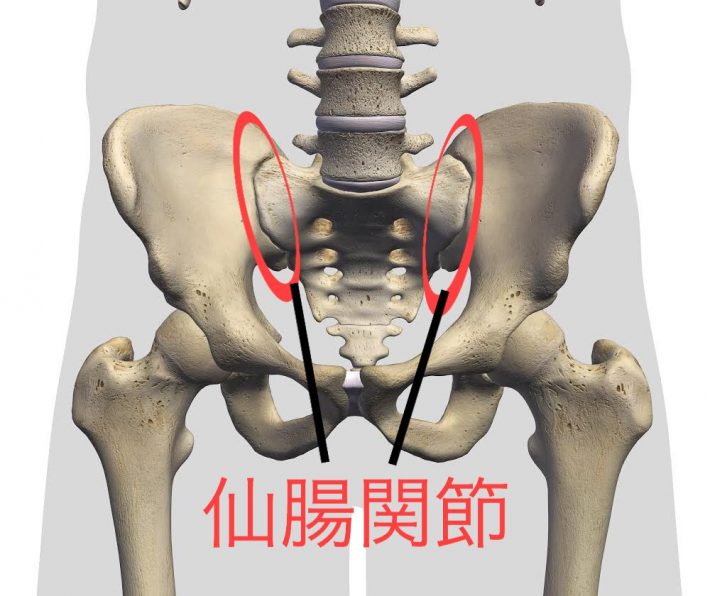 女性に多い「骨盤由来の腰痛」とは？