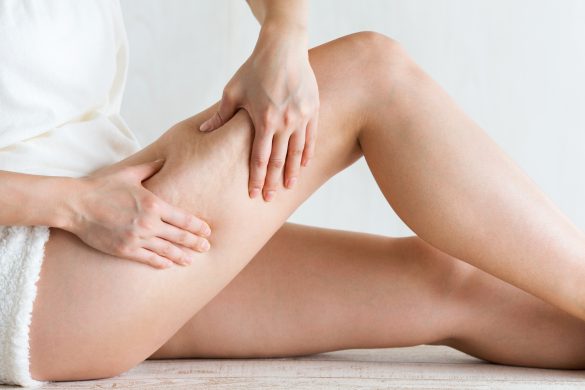 セルライトはもみ出すのが効果的