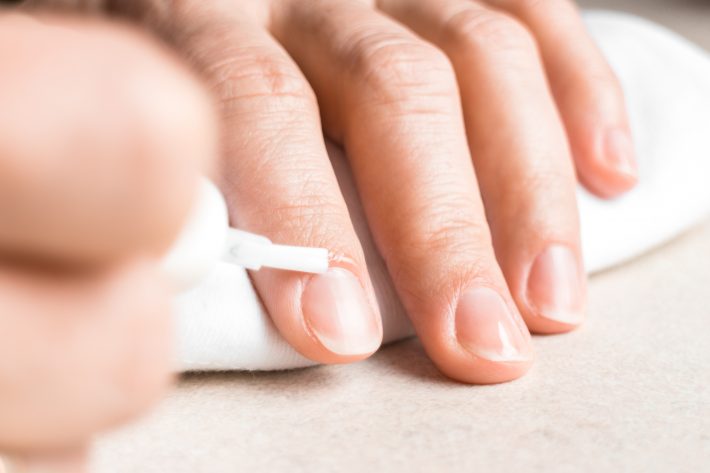 気になる爪の「タテ線」を消したい