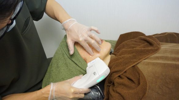 先端につけたヘッドから照射