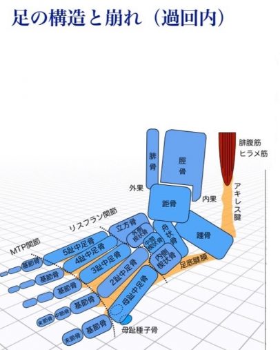 足の構造と崩れ(通回内)
