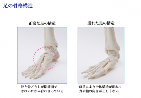 パンプス 人気 薬指 動かない