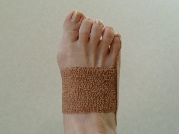 中足骨部分をテーピングで締めて、小指をまっすぐに固定