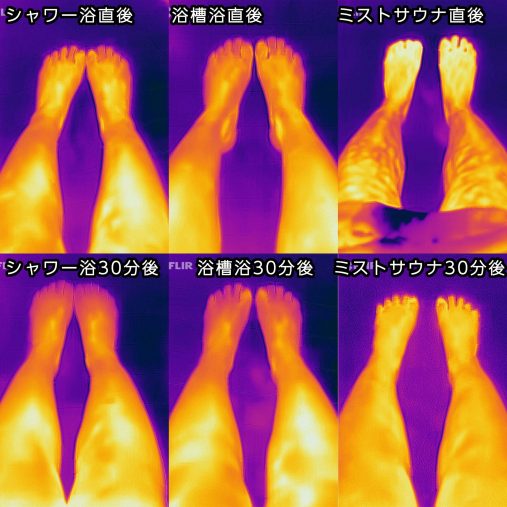 足パターンの30分後