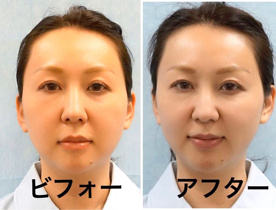 （画像：麹町皮ふ科 形成外科クリニック公式Facebookより）