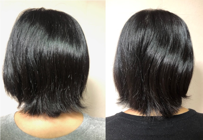 ビフォーアフター