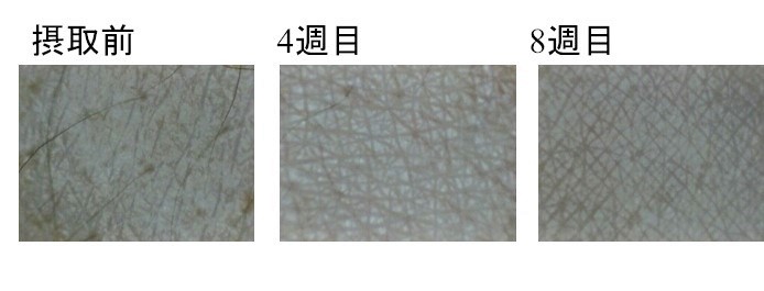 カルダス肌試験_撮影画像