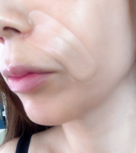 ヤーマン「メディリフト3Dマイクロフィラー」