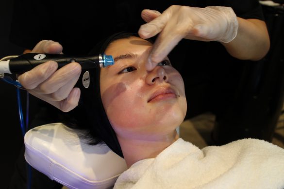 ハイドラフェイシャル2