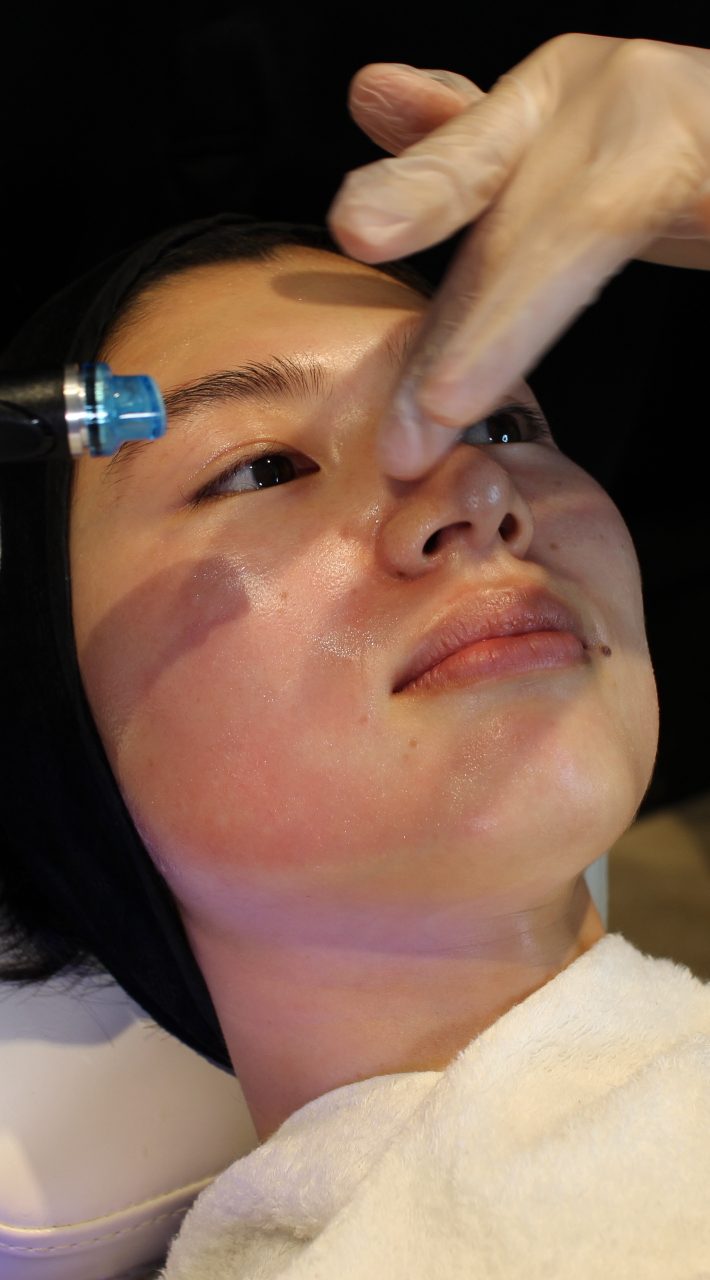 ハイドラフェイシャル2