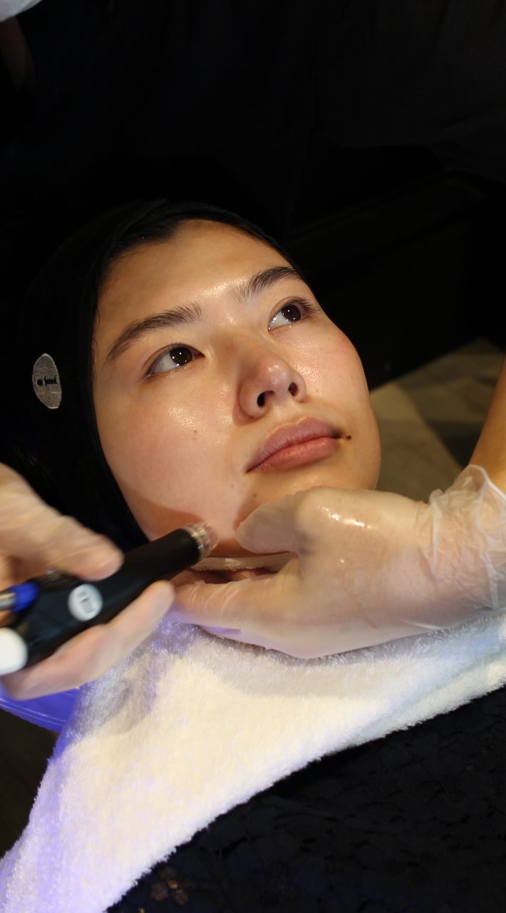 ハイドラフェイシャル9