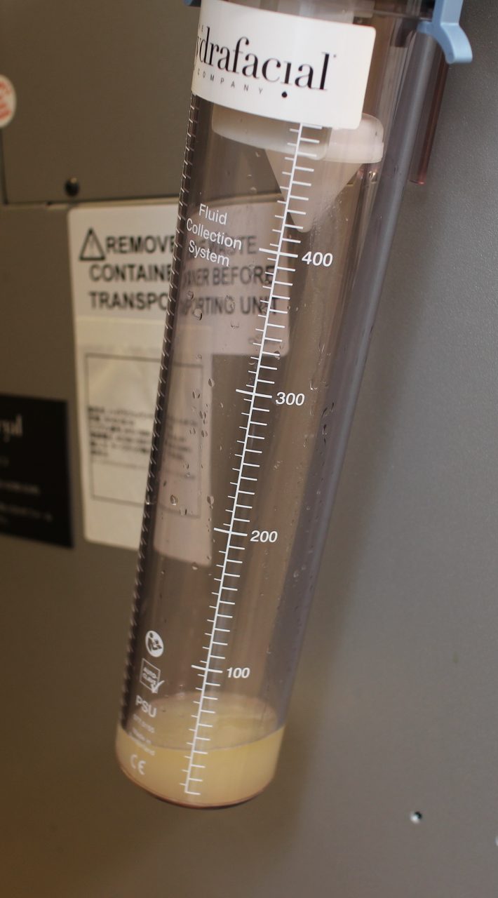 ハイドラフェイシャル7