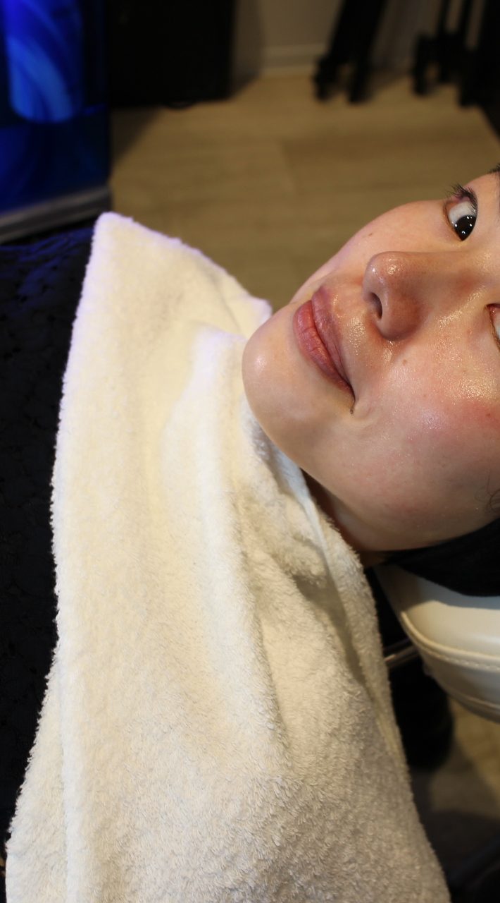 ハイドラフェイシャル10