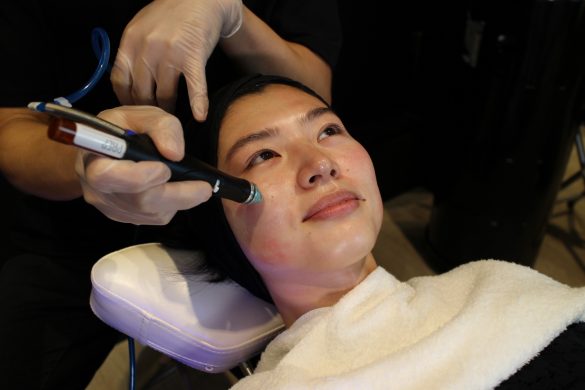 ハイドラフェイシャル4