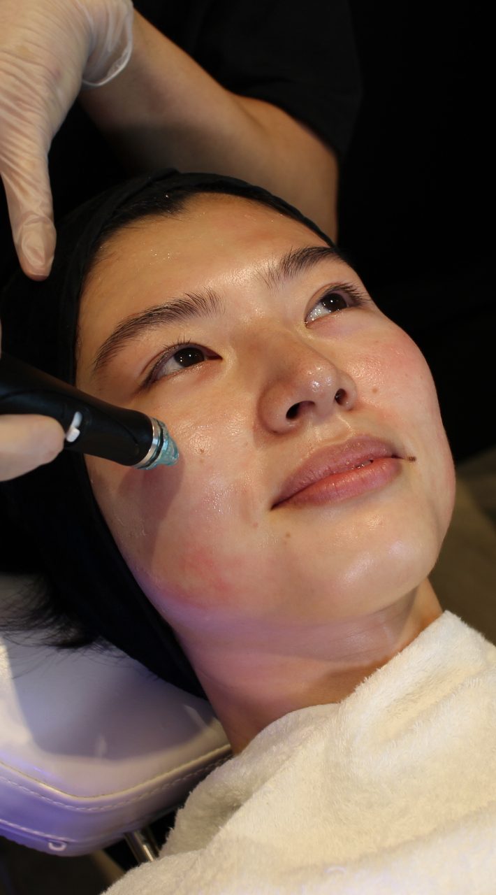 ハイドラフェイシャル4