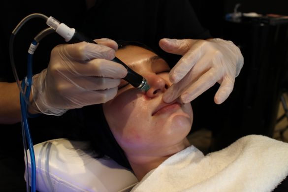 ハイドラフェイシャル6