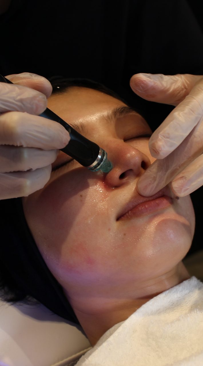 ハイドラフェイシャル6