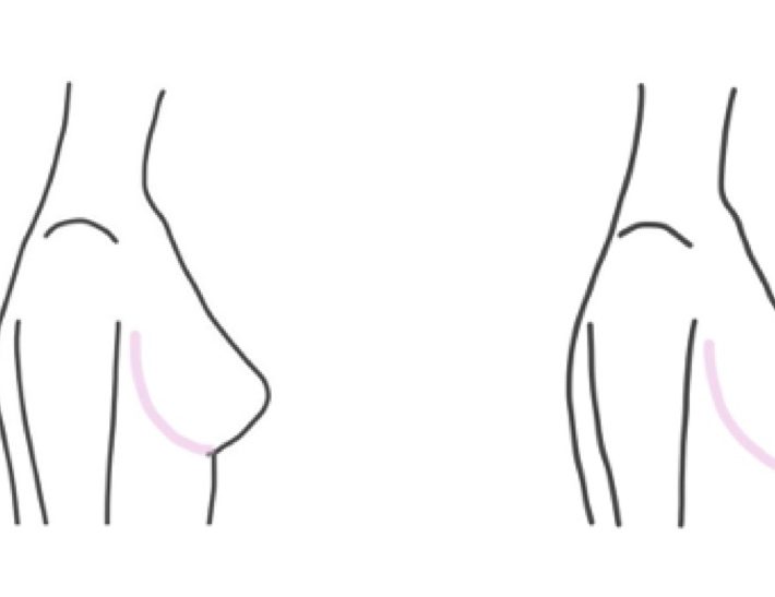 同じカップ、アンダーサイズでも採寸結果は異なることがある