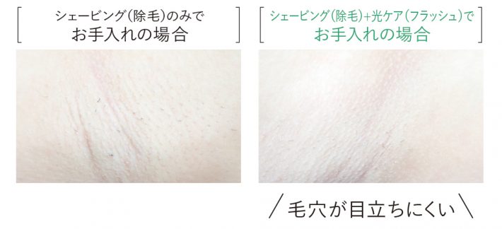 光エステ肌の状態を比較