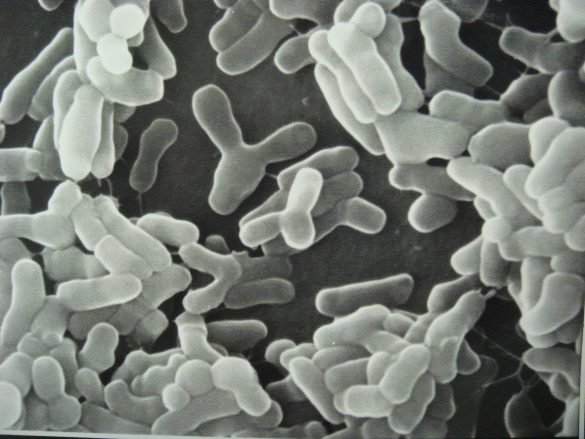 Bifidobacterium longum