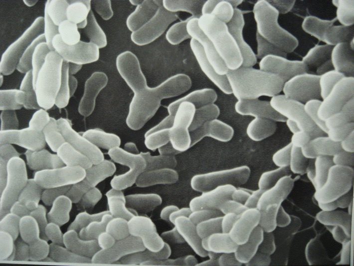 Bifidobacterium longum