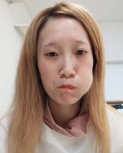 口だけ、目だけをを動かすリハビリを開始