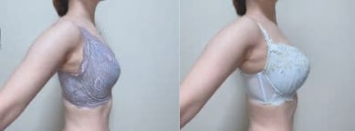 コンパクトに見えるブラジャー