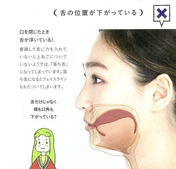 間違った舌の位置