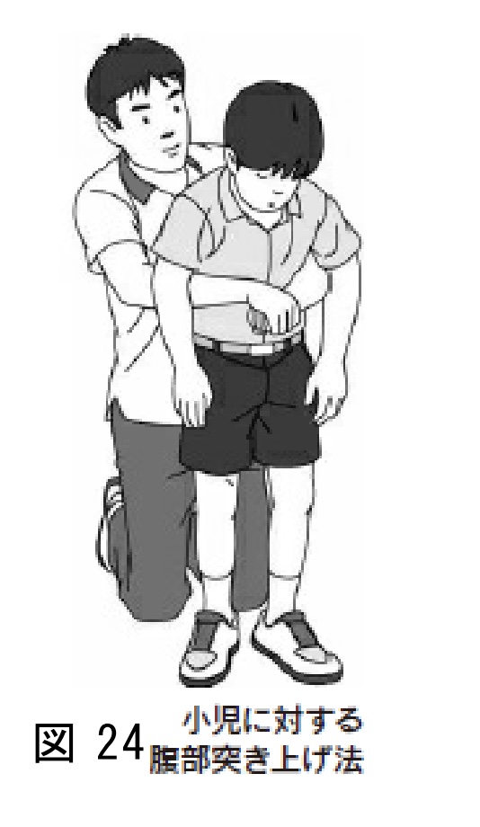 1歳以上の子どもに対する腹部突き上げ（消費者庁「食品による子どもの窒息・誤嚥事故に注意！」より）