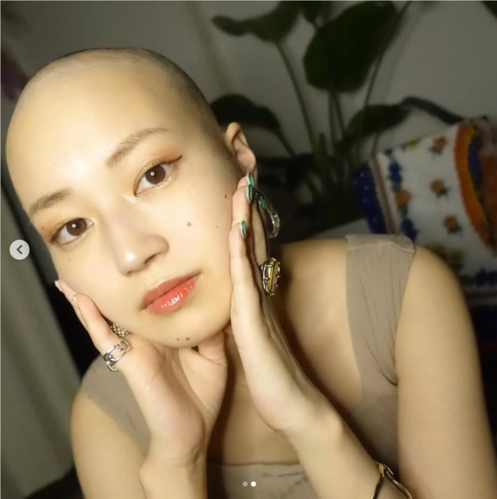 東京で治療を行うも…