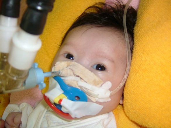 日本には大手のブランドにダウン症モデルがいない