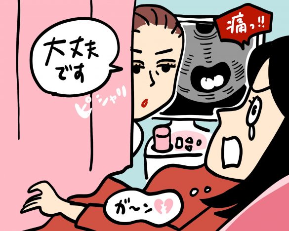 エコー