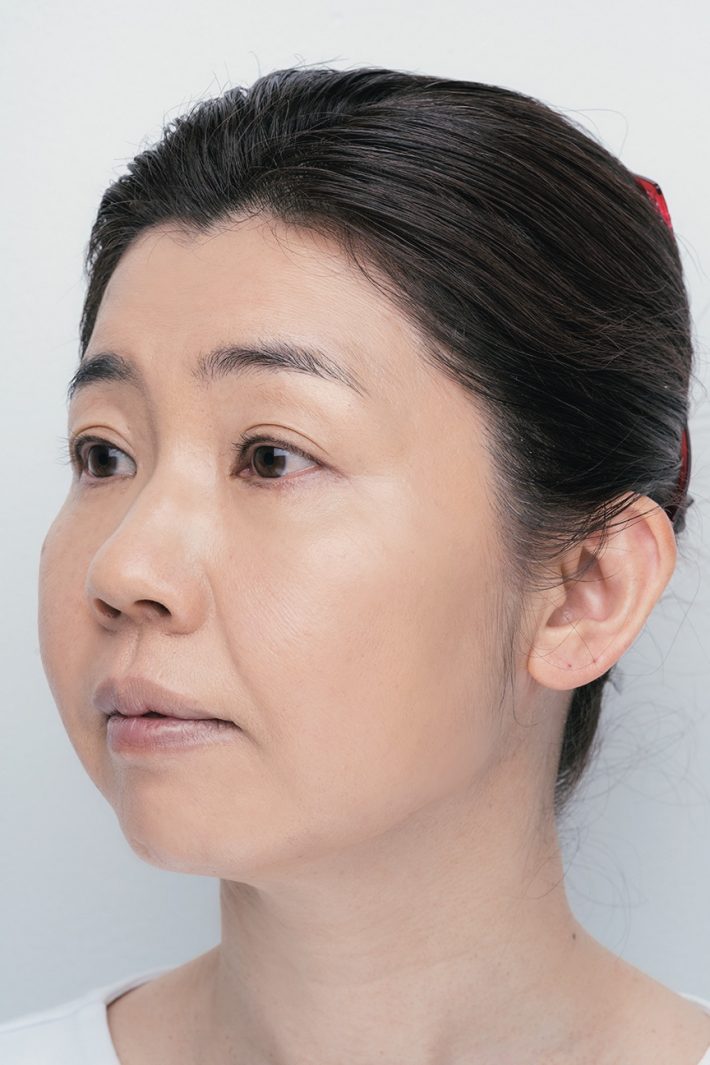 黄みの強いオークルはNG