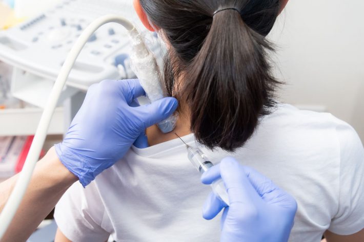 筋膜リリース注射